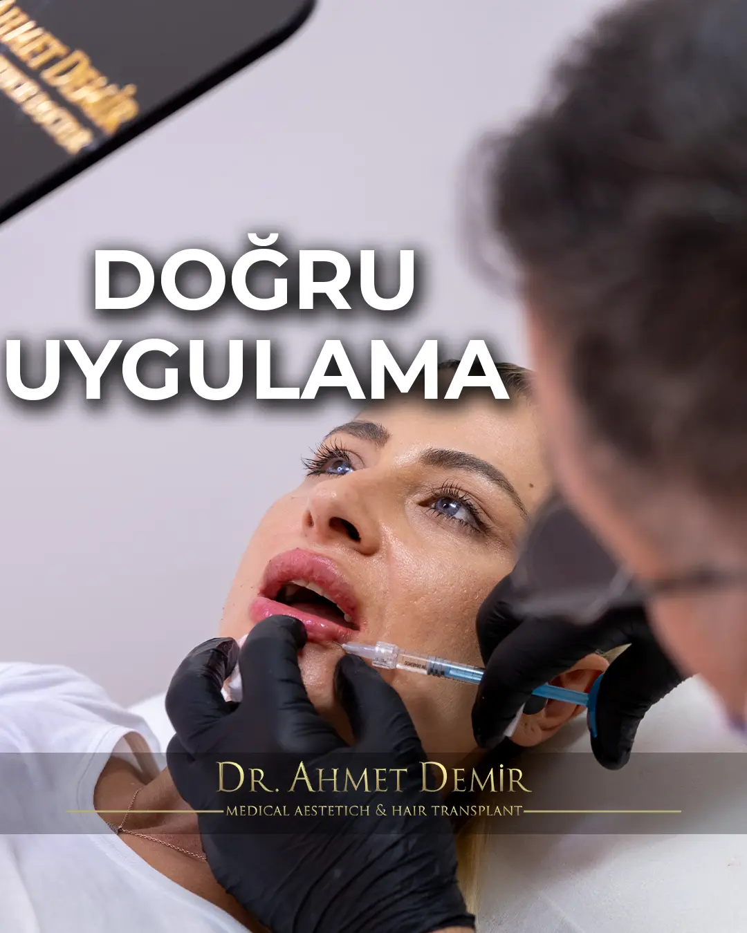 dudak-dolgusu-dogru-uygulama